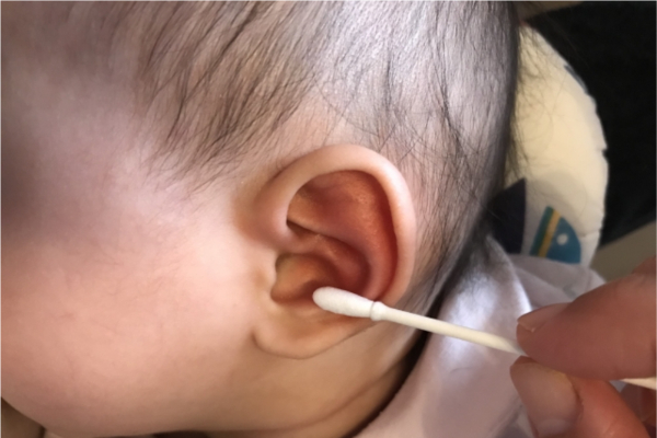 赤ちゃん耳垢掃除